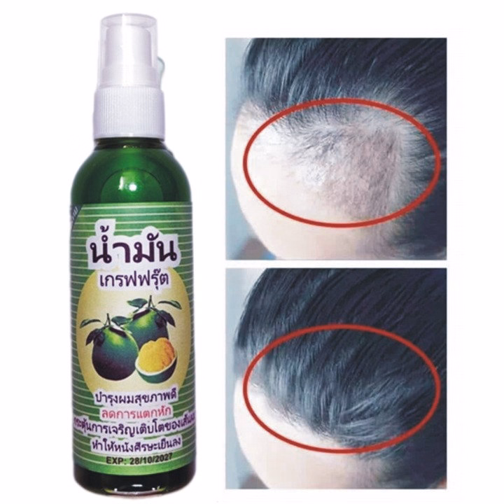 Xịt Mọc Tóc Bưởi Anh Thái Lan Kích Thích Mọc Tóc, Ngăn Ngừa Tóc Gãy Rụng Hiệu Quả 80Ml - Gdn
