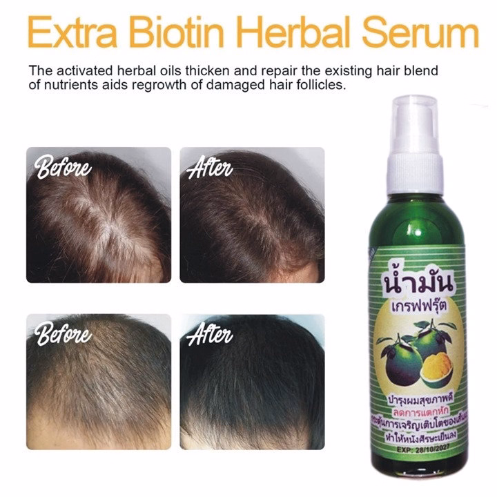 Xịt Mọc Tóc Bưởi Anh Thái Lan Kích Thích Mọc Tóc, Ngăn Ngừa Tóc Gãy Rụng Hiệu Quả 80Ml - Gdn - Ảnh 3