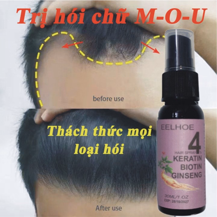 Xịt Mọc Tóc Nhân Sâm Biotin Eelhoe Tím Giám Rụng Tóc, Cải Thiện Hói Đầu, Ngăn Nấm Da Đầu 30Ml - Gdn - Ảnh 3