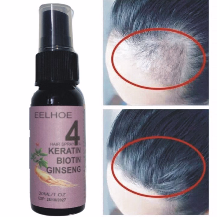 Xịt Mọc Tóc Nhân Sâm Biotin Eelhoe Tím Giám Rụng Tóc, Cải Thiện Hói Đầu, Ngăn Nấm Da Đầu 30Ml - Gdn - Ảnh 4