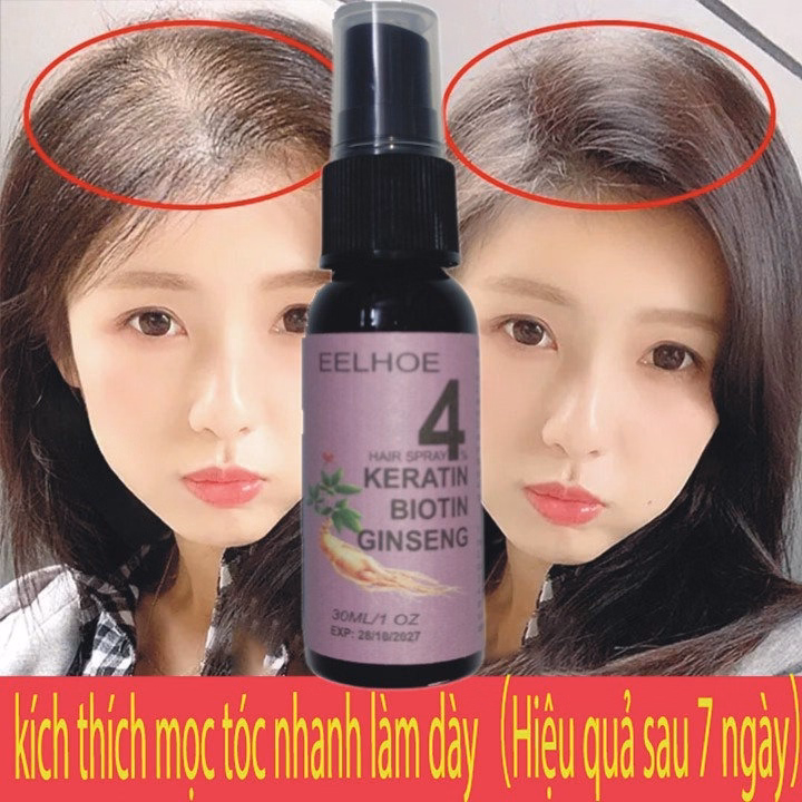 Xịt Mọc Tóc Nhân Sâm Biotin Eelhoe Tím Giám Rụng Tóc, Cải Thiện Hói Đầu, Ngăn Nấm Da Đầu 30Ml - Gdn - Ảnh 5