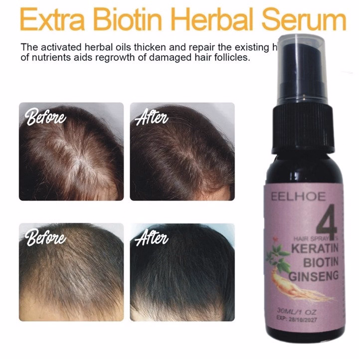 Xịt Mọc Tóc Nhân Sâm Biotin Eelhoe Tím Giám Rụng Tóc, Cải Thiện Hói Đầu, Ngăn Nấm Da Đầu 30Ml - Gdn - Ảnh 2