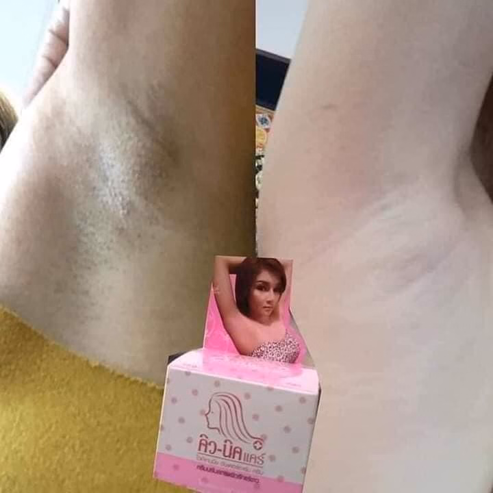 Kem Khử Thâm Nách Mông Qnic Care Thái Lan Chính Hãng 15G-Kt1 - Ảnh 4