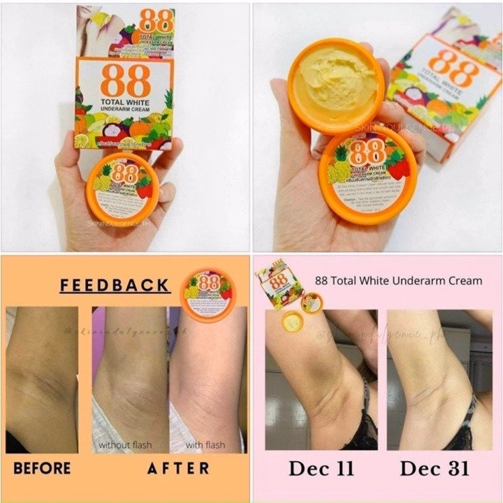 Kem Khử Thâm Nách 88 Total White Thái Lan Trắng Mịn - Gdn - Ảnh 2