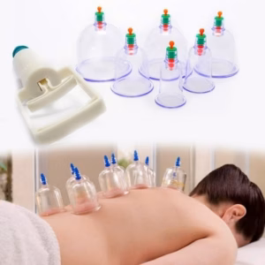 Bộ Giác Hơi Hút Chân Không Giảm Đau Mỏi