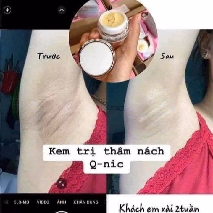 Kem Giảm Thâm Nách, Thâm Bikini, Mông , Đầu Gối Q-Nic Care Kt1 - Ảnh 4
