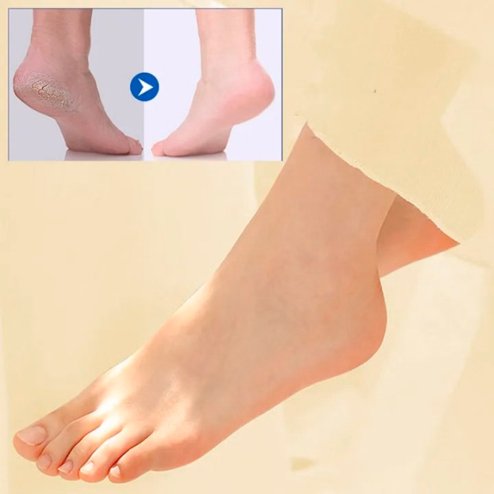 Gel Bôi Nứt Gót Chân Heyxi 30Gr - Gdn - Ảnh 5