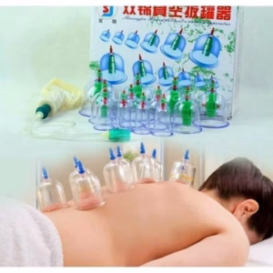 Bộ Giác Hơi Hút Chân Không Giảm Đau Mỏi Ê Nhức