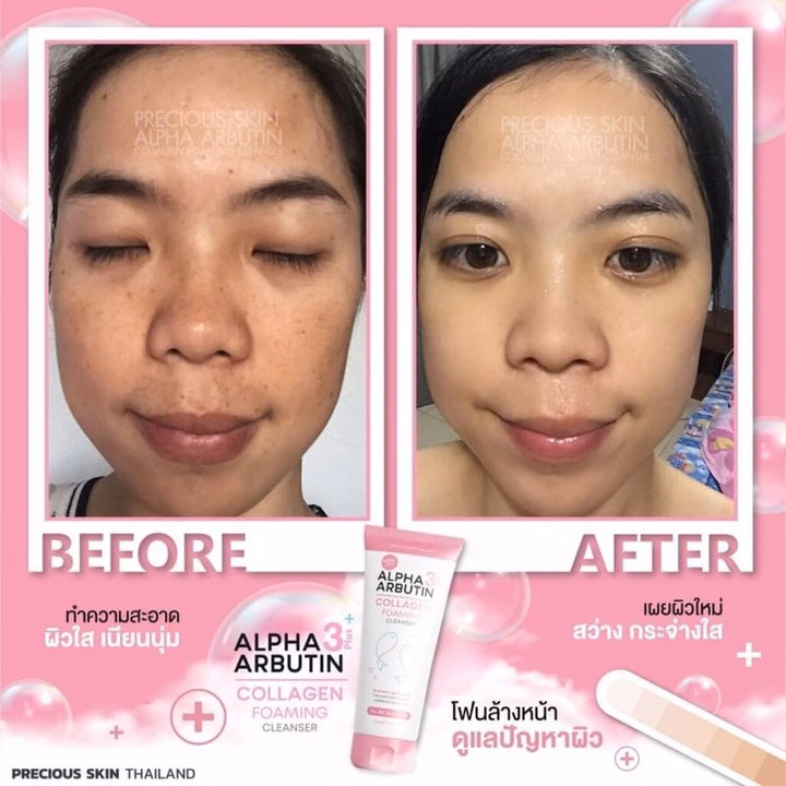 Sữa Rửa Mặt Trắng Da Ngăn Ngừa Mụn Alpha Arbutin Lollagen Foaming Cleanser Thái Lan 120Ml - Gdn - Ảnh 3