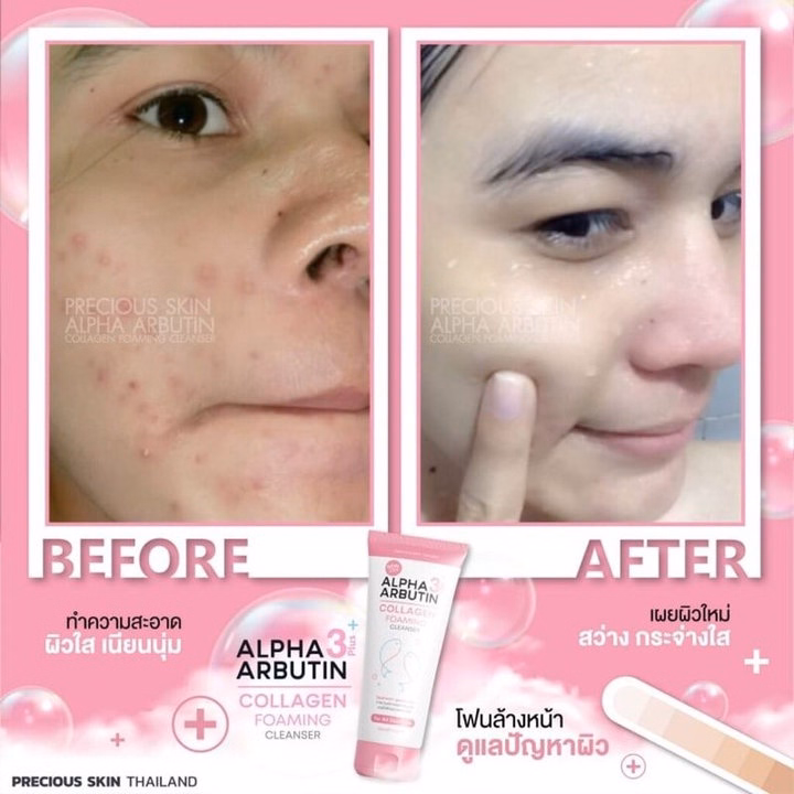 Sữa Rửa Mặt Trắng Da Ngăn Ngừa Mụn Alpha Arbutin Lollagen Foaming Cleanser Thái Lan 120Ml - Gdn - Ảnh 4