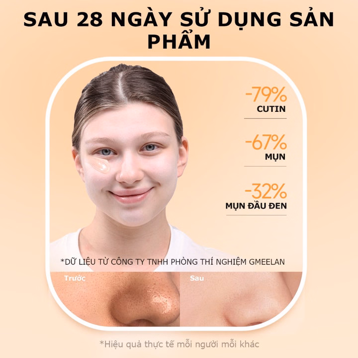 Gmeelan Gel Tẩy Tế Bào Chết Da Mặt Tác Động Cam Enzymes 50G - Gdn - Ảnh 3