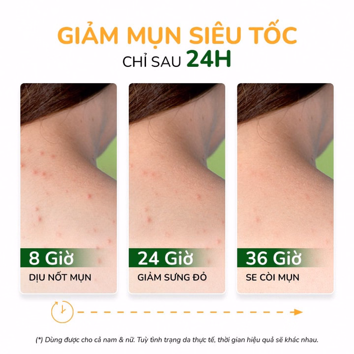 Xịt Giảm Mụn Lưng, Giảm Viêm Nang Lông Neoacnes Sạch Mụn, Mờ Thâm Giảm Viêm 100Ml - Ảnh 3