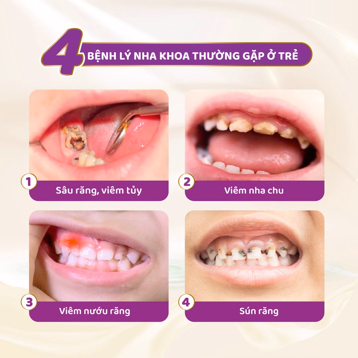 Bàn Chải Đánh Răng Trẻ Em Dental B Kid M - Ảnh 3