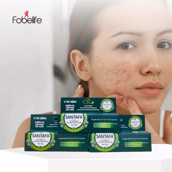 Kem Trị Mụn Bọc, Mụn Mủ Acnevir (Xanh) - Santafa - Ảnh 5