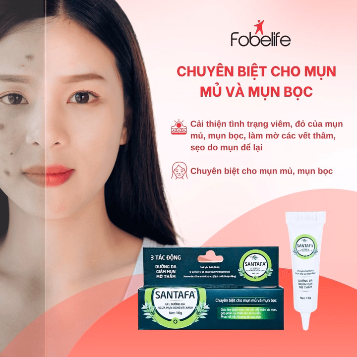Kem Trị Mụn Bọc, Mụn Mủ Acnevir (Xanh) - Santafa - Ảnh 6