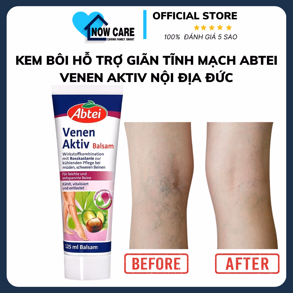 Kem Bôi Giãn Tĩnh Mạch Venen Aktiv 125Ml - Abtei