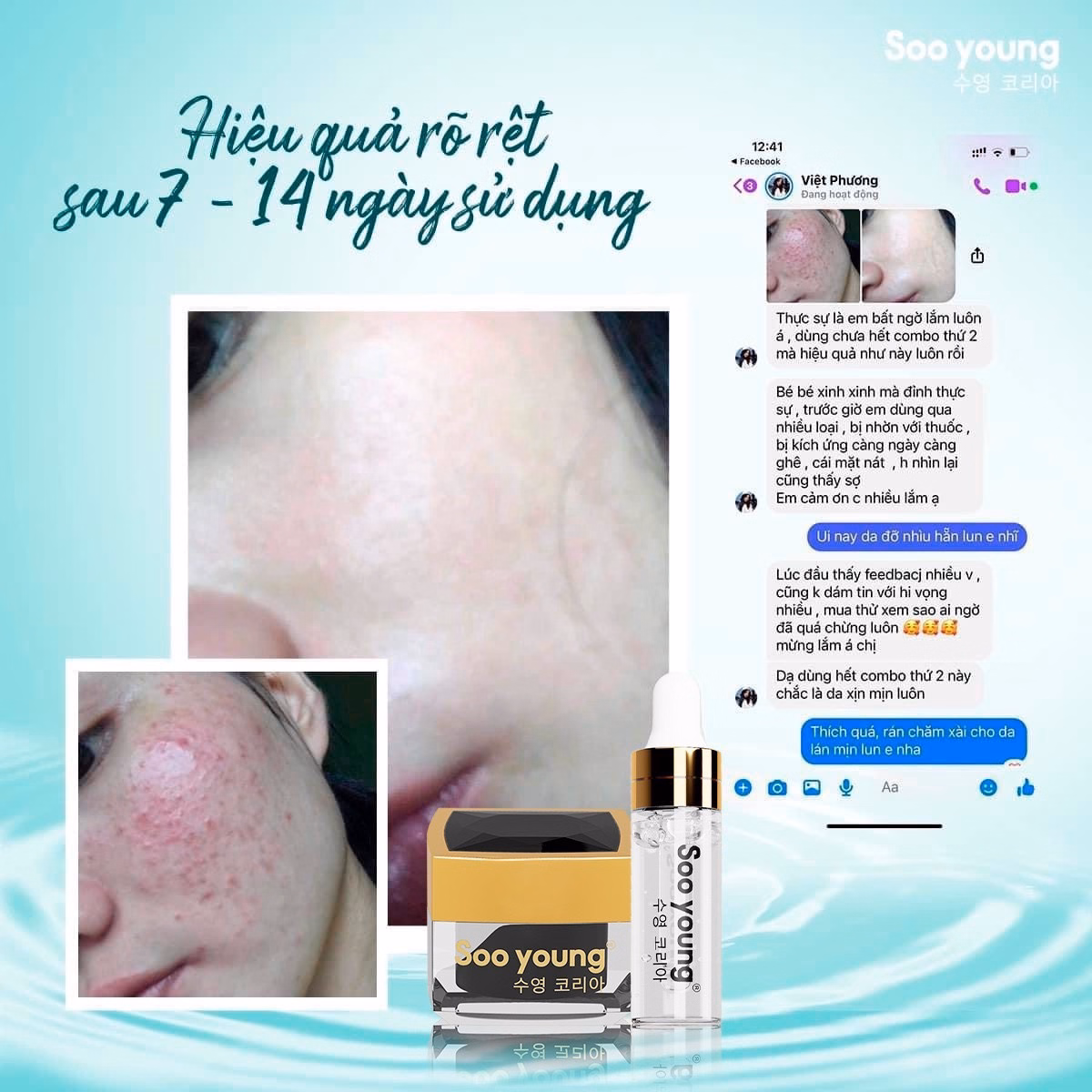 Combo Trị Mụn Acneskin Care - Soo Young - Ảnh 14