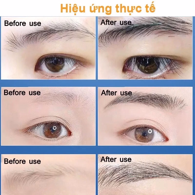 Dưỡng Mày Fkn - Mọc Lông Mày Dài, Dày, Chắc Khỏe Cực Hiệu Quả - Mỹ Phẩm 24H - Ảnh 9