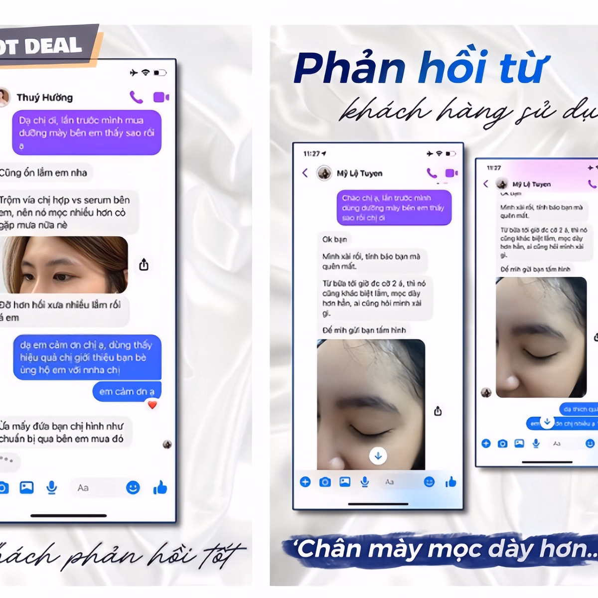 Dưỡng Mày Fkn - Mọc Lông Mày Dài, Dày, Chắc Khỏe Cực Hiệu Quả - Mỹ Phẩm 24H - Ảnh 6