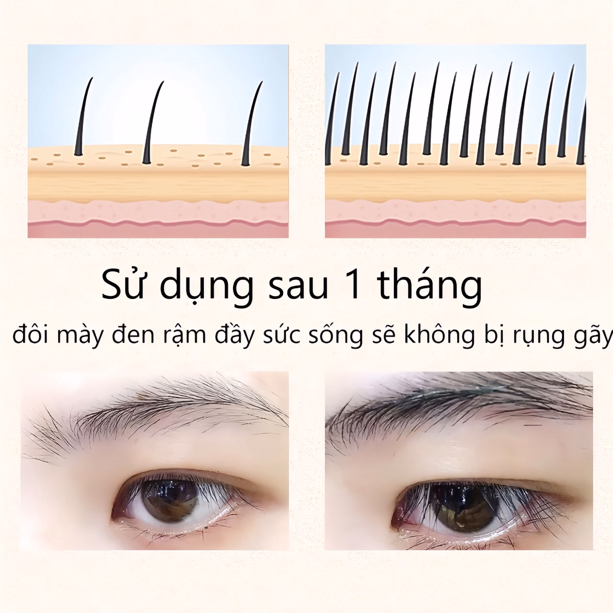 Dưỡng Mày Fkn - Mọc Lông Mày Dài, Dày, Chắc Khỏe Cực Hiệu Quả - Mỹ Phẩm 24H - Ảnh 12