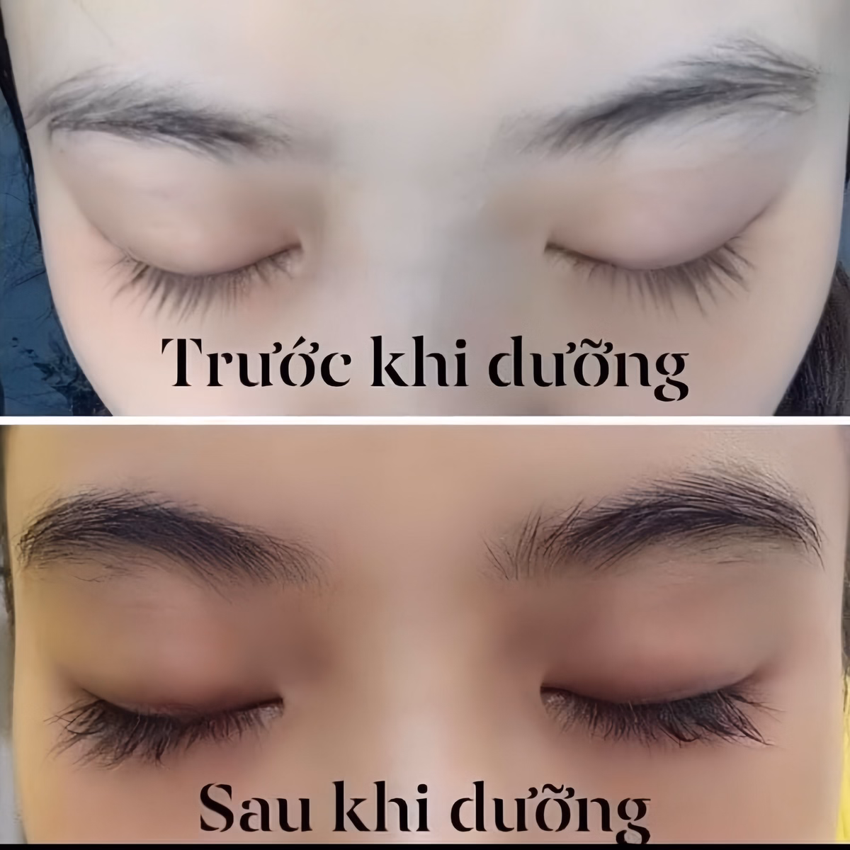 Dưỡng Mày Fkn - Mọc Lông Mày Dài, Dày, Chắc Khỏe Cực Hiệu Quả - Mỹ Phẩm 24H - Ảnh 10