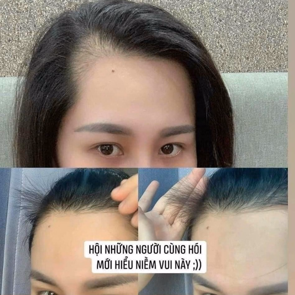 Tinh Chất Mọc Tóc Nhật Bản - Sato - Ảnh 3