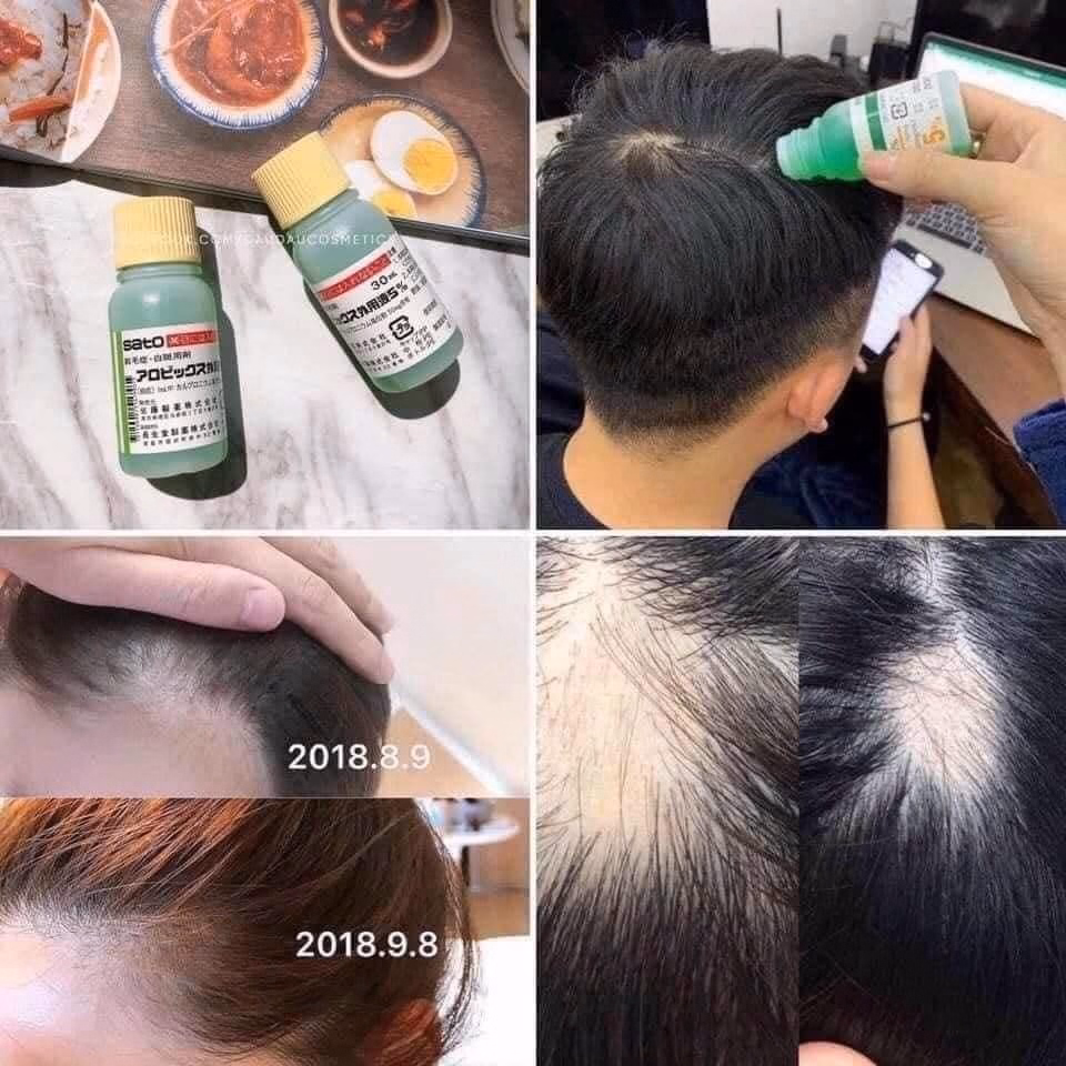 Tinh Chất Mọc Tóc Nhật Bản - Sato - Ảnh 8