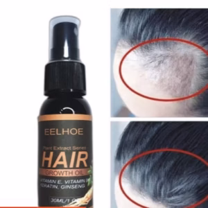 Xịt Mọc Tóc Nhân Sâm Giảm Rụng, Kích Mọc, Cải Thiện Hói Nấm Da Đầu 30Ml - Gdn