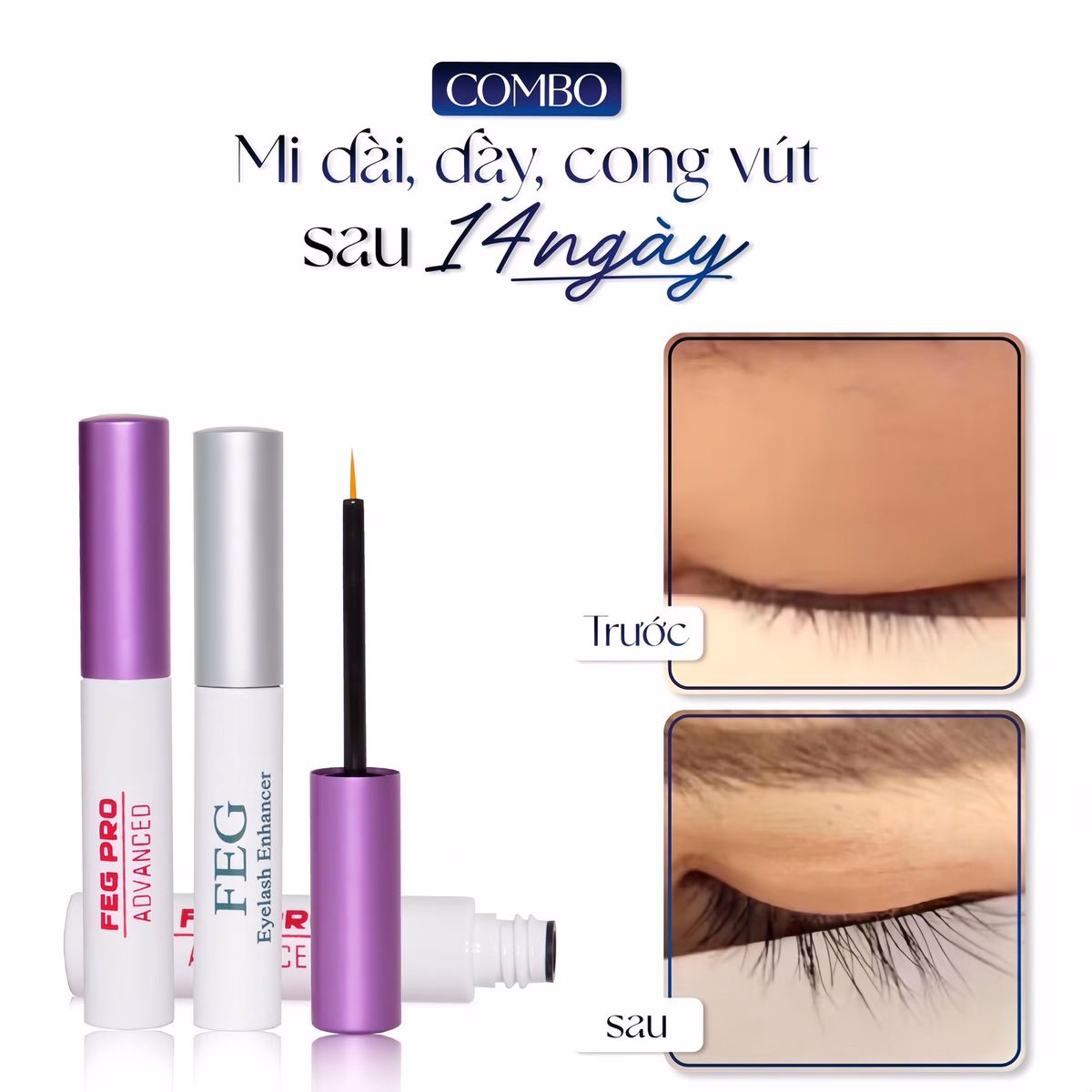 Dưỡng Mi Feg Eyelash - Mi Dài Lung Linh, Chắc Khỏe - Mỹ Phẩm 24H - Ảnh 2