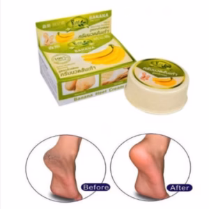 Kem Nứt Gói Chân Banana Heel Cream - Gdn
