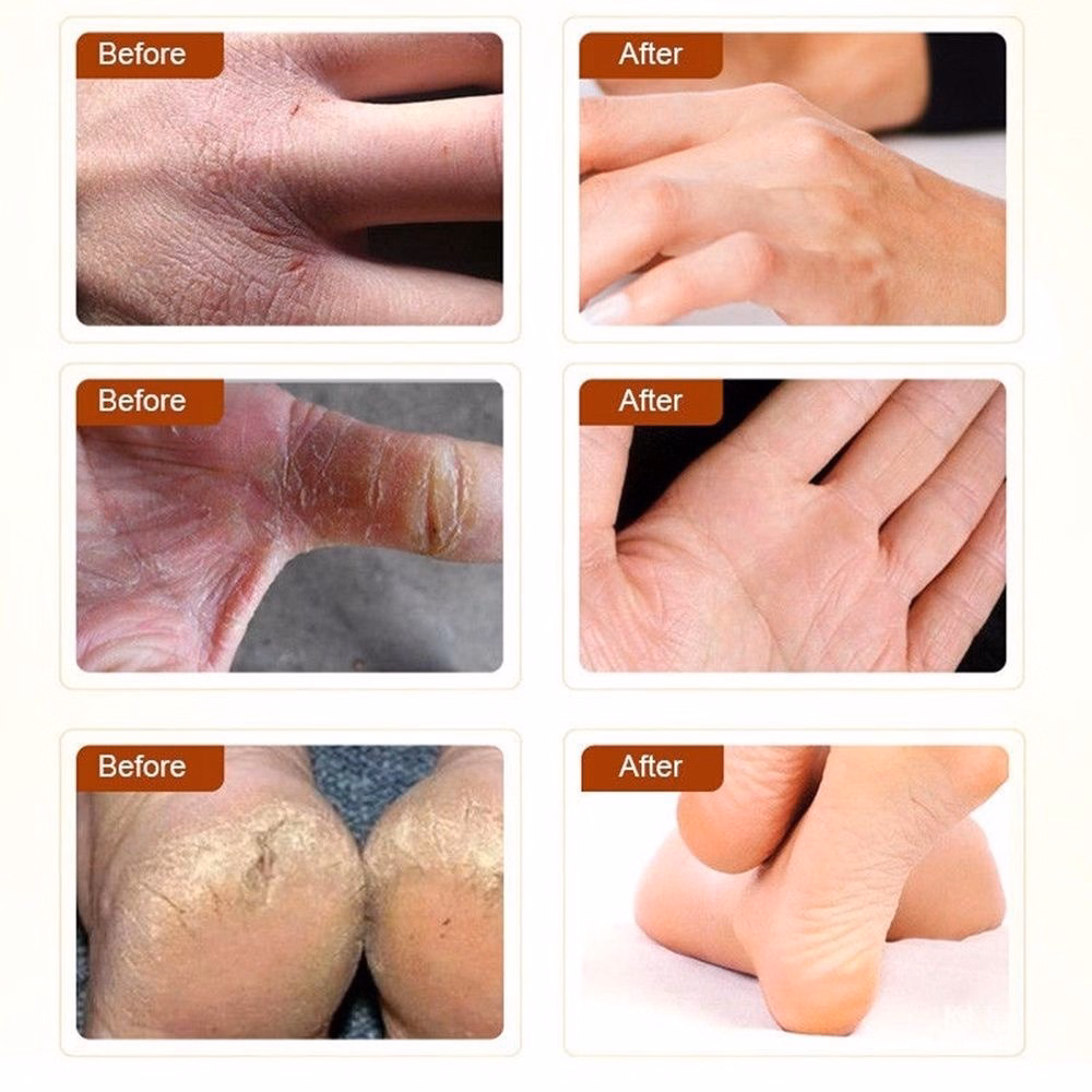 Kem Dưỡng Ẩm Chống Nứt Nẻ Da Hanboli Heyxi 20G - Be Yourself - Ảnh 6