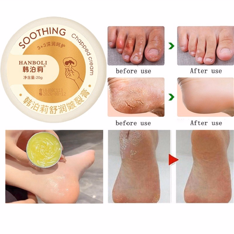 Kem Dưỡng Ẩm Chống Nứt Nẻ Da Hanboli Heyxi 20G - Be Yourself - Ảnh 4