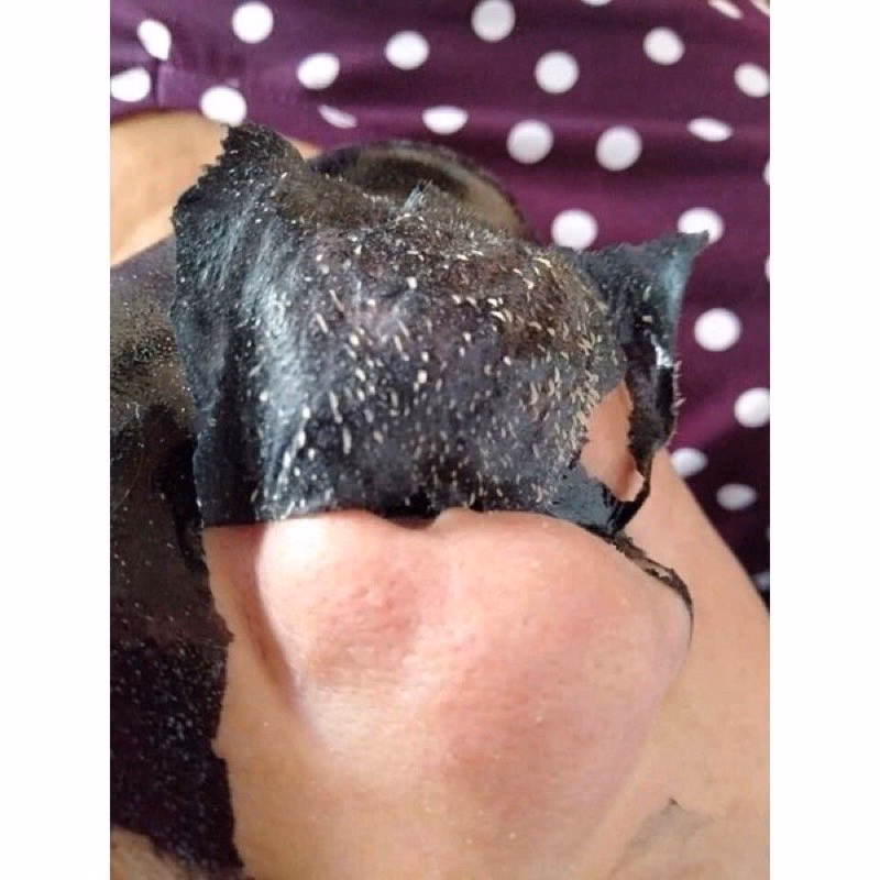 Lột Mụn Than Tre Pháp - Be Yourself - Ảnh 3