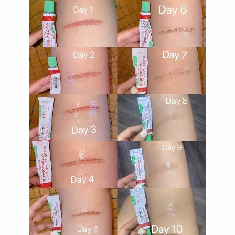 Kem Sẹo Gentacin Làm Mờ Sẹo Lồi, Sẹo Rỗ ,Sẹo Thâm Nhật Bản 10G - Be Yourself - Ảnh 4