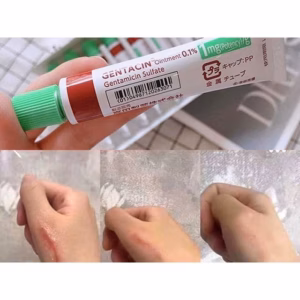 Kem Sẹo Gentacin Làm Mờ Sẹo Lồi, Sẹo Rỗ ,Sẹo Thâm Nhật Bản 10G - Be Yourself