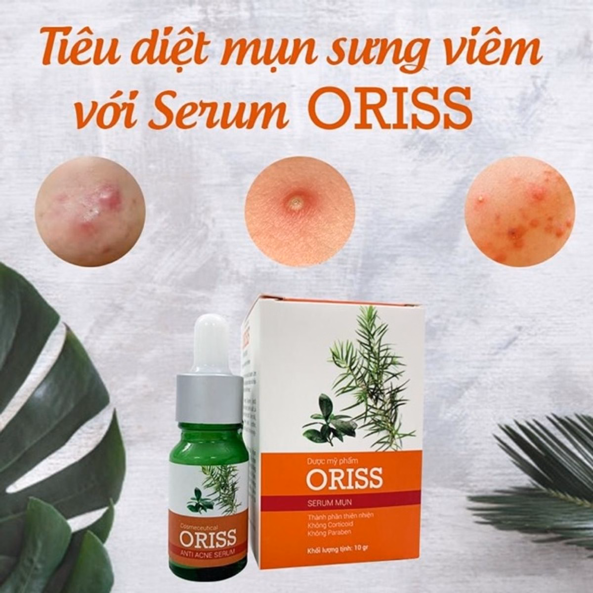 Serum Ngừa Mụn Làm Mờ Thâm Mụn Oriss 10G - Ảnh 6